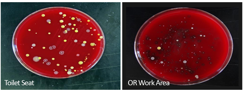 Cultured bacteria collected from toilet seat compared to OR work area